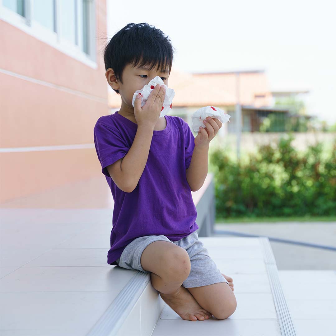 小朋友無緣無故流鼻血的3個常見原因 | AQ BIO修護配方科技水修復鼻黏膜組織