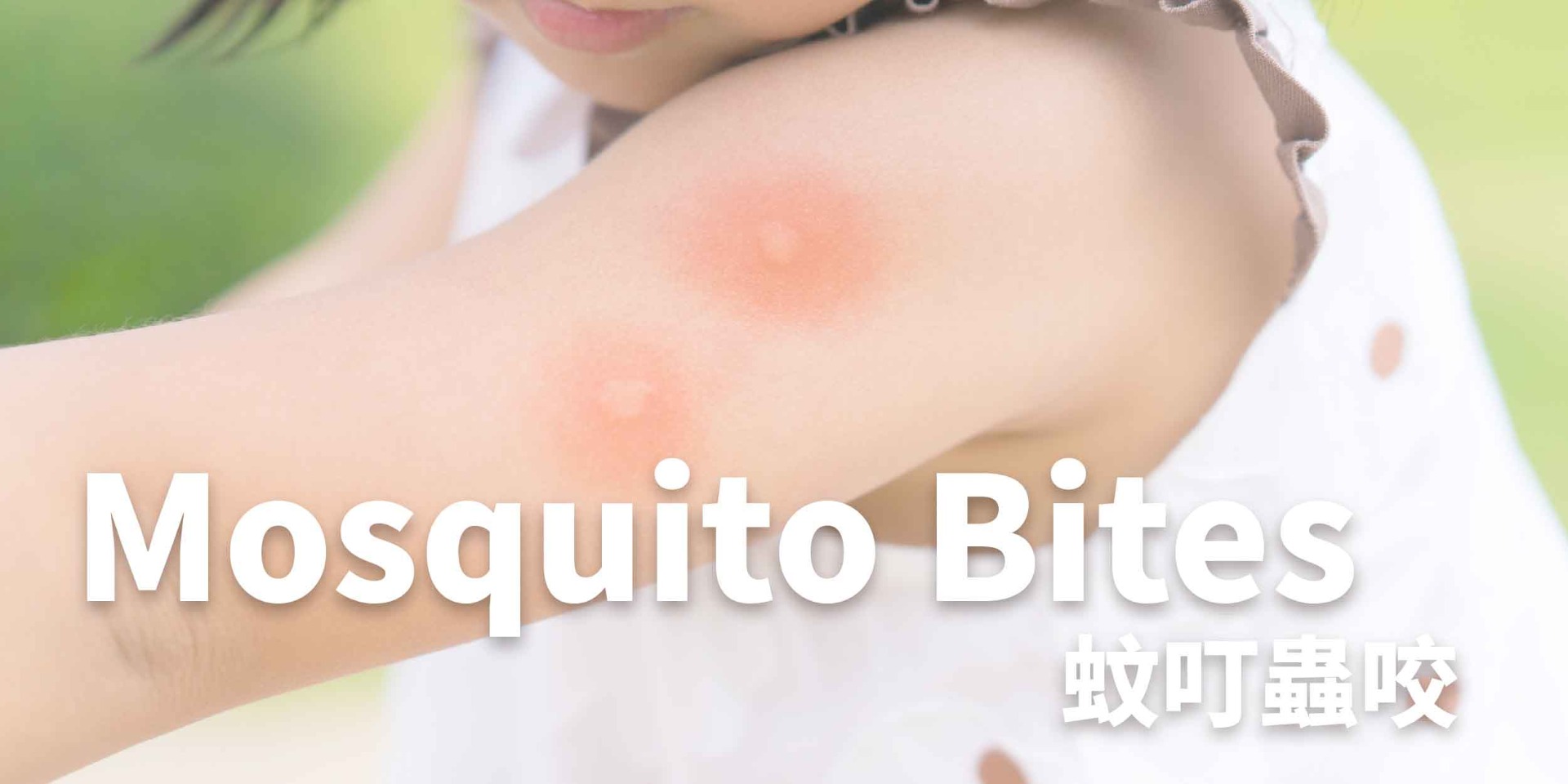 蚊叮蟲咬,AQ Bio消毒殺菌噴霧、殺菌達99.9999%, 對抗濕疹,暗瘡,皮膚敏感,念珠菌,鼻敏感,喉嚨痛, 助皮膚修護細胞, 產生抗菌能
